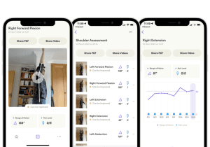 Range of motion measured by ai. Image shows a health app that measures shoulder ROM and displays progress through recovery of the patient