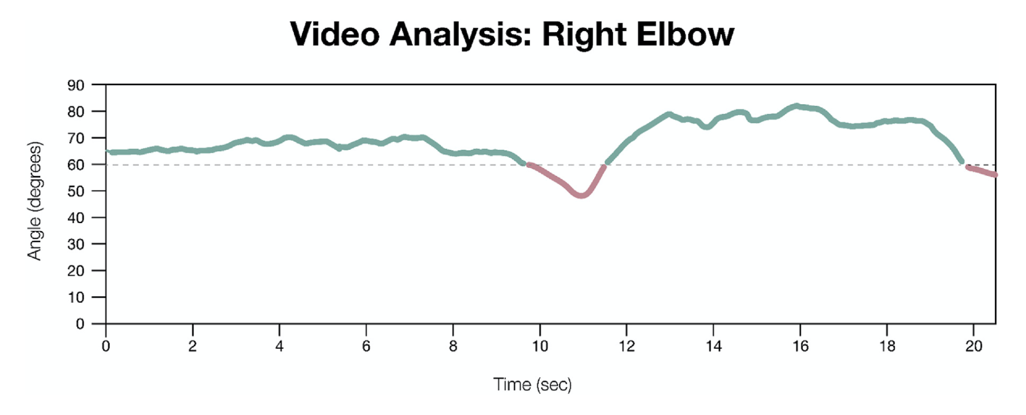 Ergonomics AI Study shows graph of time vs elbow angle. The graph shows the result of a 20 second time period where a surgeon's elbow moved into an unsafe angle >60 degrees. Image shows the possibilities of AI and ergonomics.