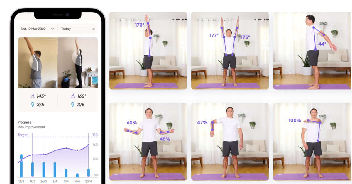 Reflex: Track Shoulder Mobility Recovery with AI