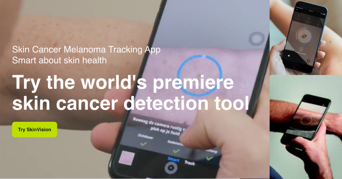 SkinVision - AI Powered Skin Cancer Detection App